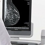 Ψηφιακή Μαστογραφία