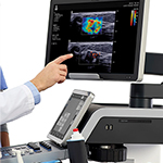 Ελαστογραφία ήπατος (Shear Wave)